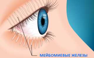 Лечение мейбомита верхнего и нижнего века